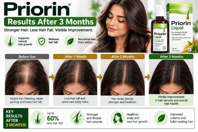 priorin results after 3 months